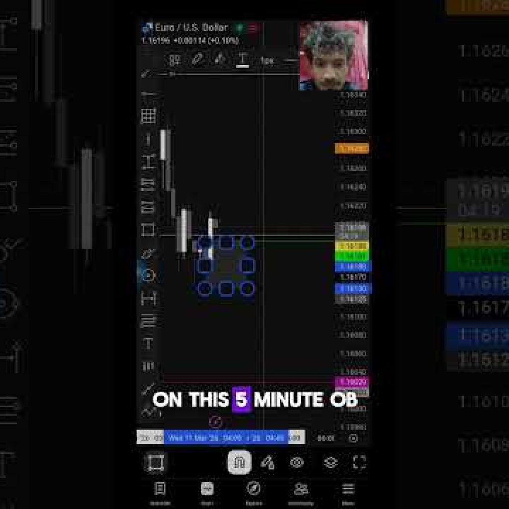 Day 9 | Documenting My Trading Session #shorts  #forex #indices #motivation