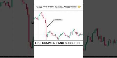 MACD Indicator Explained 😳 | Beginner to Pro!” Part 01