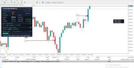 Gold Live Trading 🔴 | XAUUSD Live Chart Analysis | Scalping Signals | XAUUSD