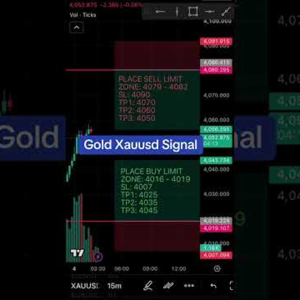 Ready for God Xauusd New Trade
