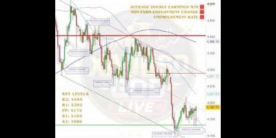 π΄ 2 October 2026 #xauusd #analysis #gold #forex #trading #trader #learning #trade @XAUUSDGODLIVE